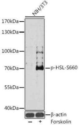 Western Blot: Hormone-sensitive Lipase/HSL [p Ser660] AntibodyAzide and BSA Free [NBP3-05459]